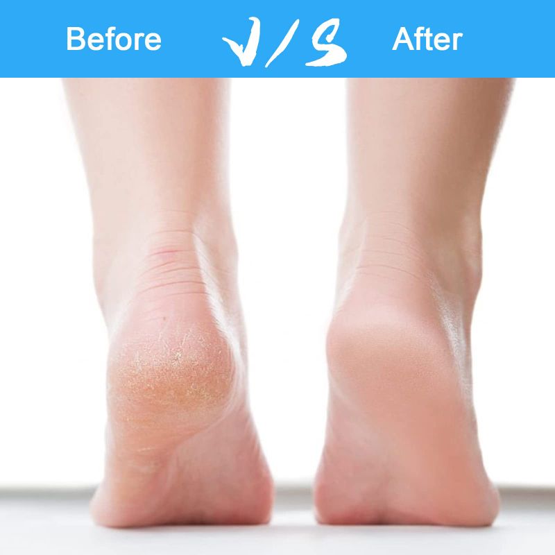 Пилка Для Пяток Электрическая