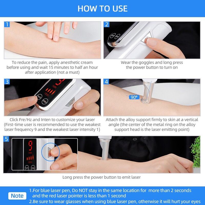 Лазер Для Удаления Татуировок