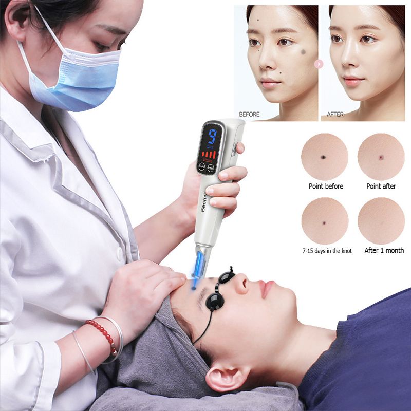 Лазер Для Удаления Татуировок