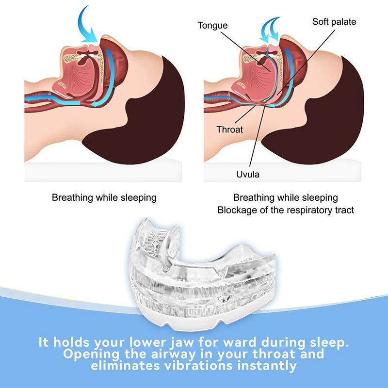 Капа От Бруксизма