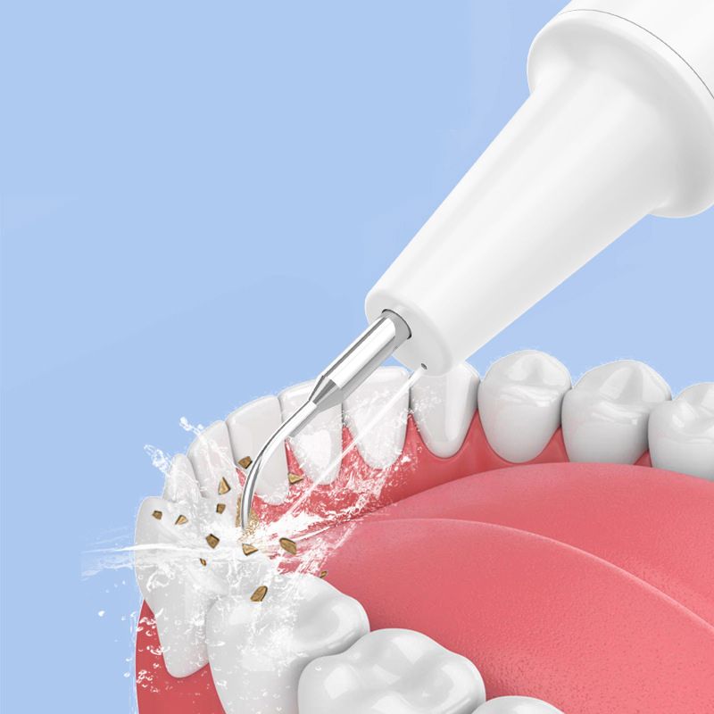 Скалер ультразвуковой