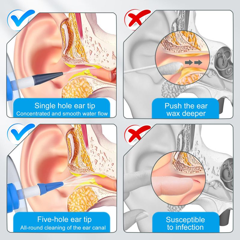 Наушники Для Чистки Ушей От Серы